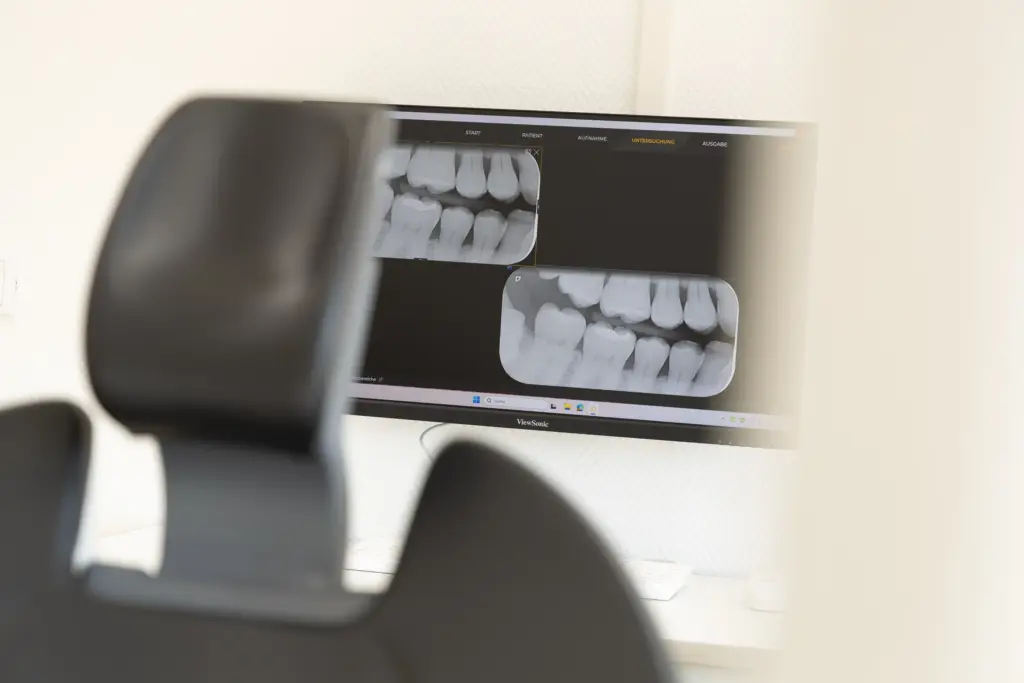 3D Röntgendiagnostik in der Zahnarztpraxis Ulsterdent in Hilders